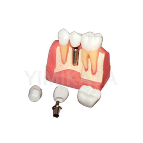 Modelo de enseñanza, Consumibles dentales, material dental, clinica dental, dent